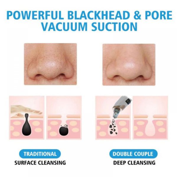 Electric Blackhead Suction