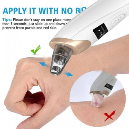 Electric Blackhead Suction