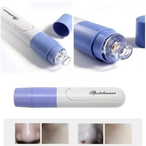 Electric Blackhead Remover