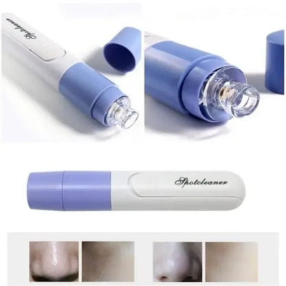 Electric Blackhead Remover